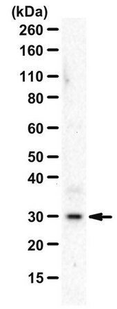 anti-interleukin-1beta (c15-1315-705)