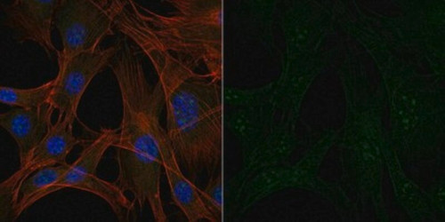anti-interleukin-1beta antibody, alexa fluor 488 conjugate (c15-1315-706)
