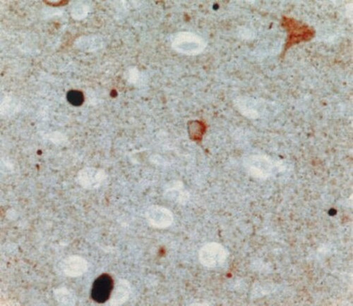 anti-synuclein alpha antibody (c15-1316-167)
