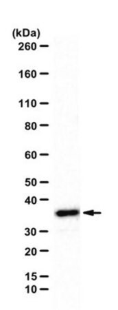 anti-sorting nexin-11 antibody (c15-1316-645)
