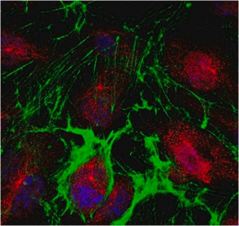 anti-ppar-gamma antibody (c15-1317-365)