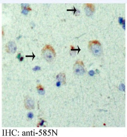 anti-app antibody, aep-cleaved (585n) (c15-1317-395)