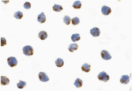 anti-ire1p antibody (c15-1317-601)