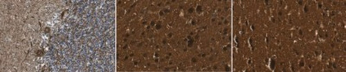anti-gad 65/67 (c15-1317-654)