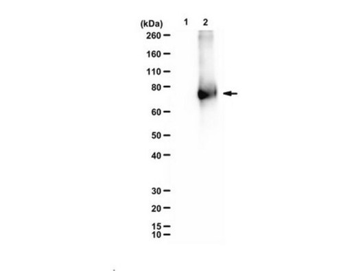 anti-hmg-lysine (c15-1317-797)
