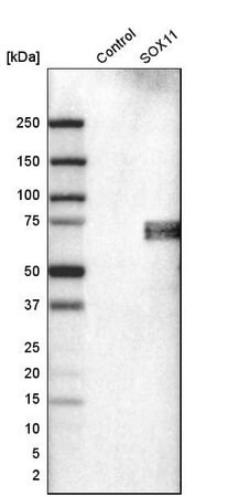 monoclonal anti-sox11 antibody produced in mouse (c15-1318-434)