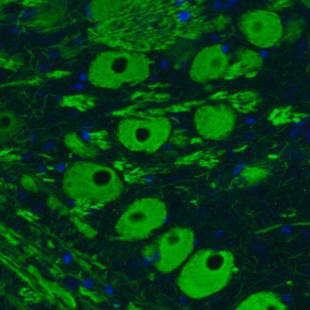 monoclonal anti-nefm antibody produced in mouse (c15-1318-652)