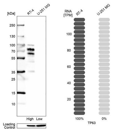 monoclonal anti-tp63 antibody produced in mouse (c15-1318-737)