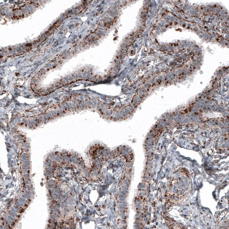 monoclonal anti-lamp1 antibody produced in mouse (c15-1318-775)