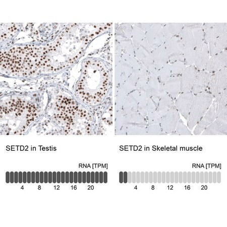 monoclonal anti-setd2 antibody produced in mouse (c15-1318-930)