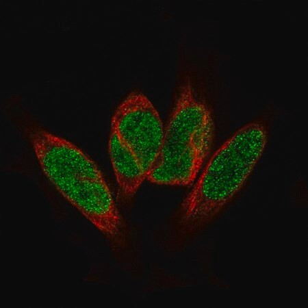 anti-gli1 antibody produced in mouse (c15-1318-963)