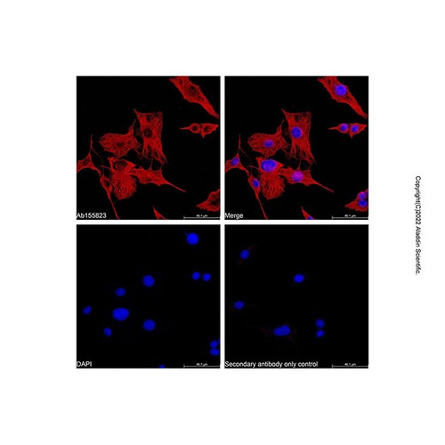goat anti-mouse igg h&l (af555) (c007b-552649)
