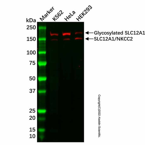 recombinant slc12a1/nkcc2 antibody (c007b-569940)