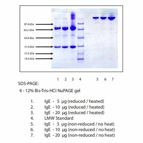 immunoglobulin e (ige), human myeloma plasma, kappa (c007b-573422)