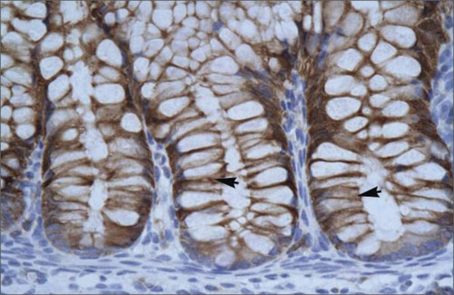 anti-suv39h1 antibody produced in rabbit