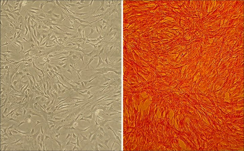 bovine pulmonary artery smooth muscle cells: bpasmc (cryovial)