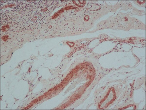 anti-mouse igg (whole molecule)-biotin antibody produced in rabbit