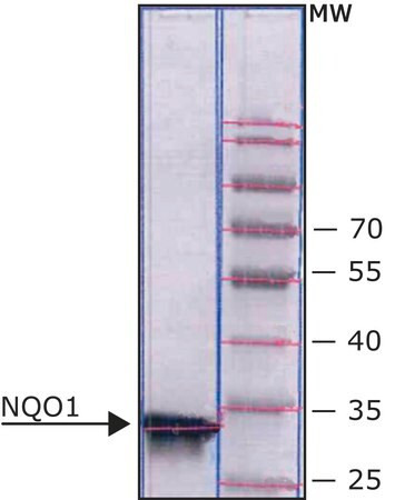 dt diaphorase (nqo1) human