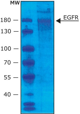 epidermal growth factor receptor human (c15-1356-813)