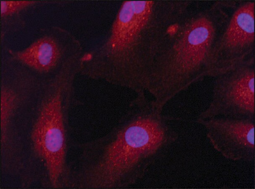 anti-eif2bbeta (n-terminal) antibody produced in rabbit