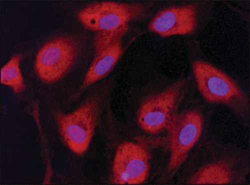 anti-eif2bepsilon antibody produced in rabbit