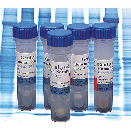 Mouse Liver Smooth ER Cell Fractions GenLysate , 150 g
