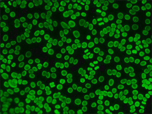 anti-human igg (whole molecule)-fitc antibody produced in rabbit (c15-1425-013)