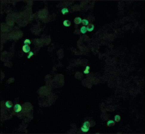 monoclonal anti-hla class i antigen antibody produced in mouse (c15-1444-457)