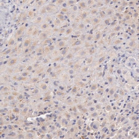 anti-c1r antibody produced in rabbit (c15-1445-224)