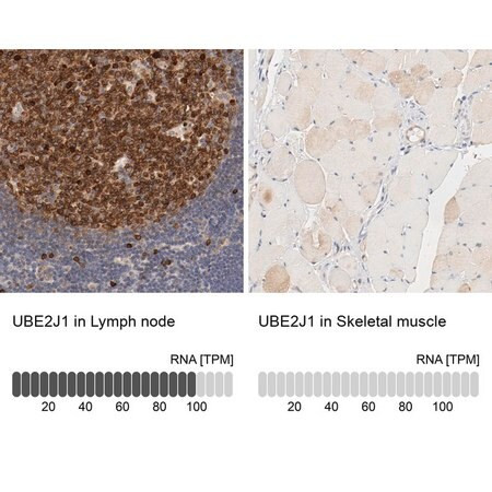 anti-ube2j1 antibody produced in rabbit
