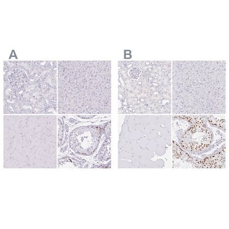 anti-cxorf67 antibody produced in rabbit (c15-1446-130)