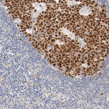 anti-mef2b antibody produced in rabbit (c15-1446-245)