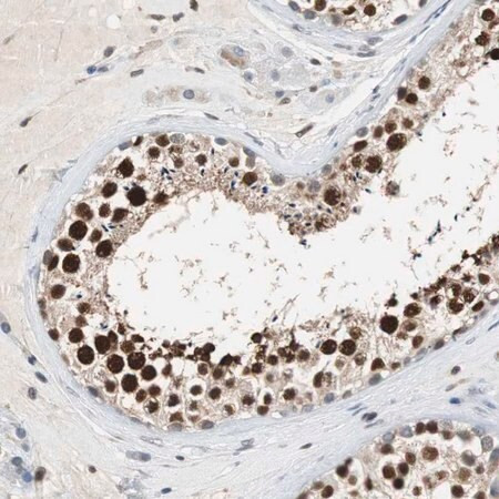 anti-sirt1 antibody produced in rabbit (c15-1446-603)