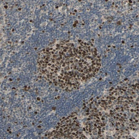 anti-rad18 antibody produced in rabbit (c15-1447-208)
