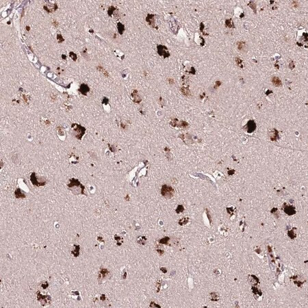 anti-card19 antibody produced in rabbit (c15-1447-478)