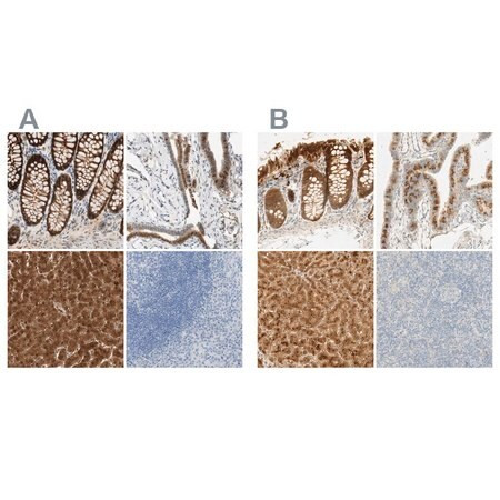 anti-selenbp1 antibody produced in rabbit (c15-1447-629)