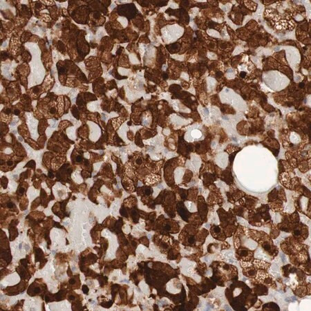 anti-parp4 antibody produced in rabbit