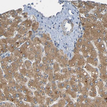 anti-cyp4f2 antibody produced in rabbit (c15-1448-063)