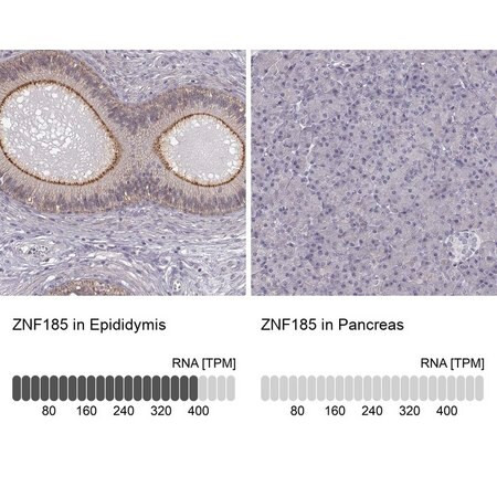 anti-znf185 antibody produced in rabbit (c15-1448-506)