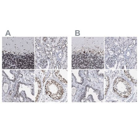 anti-tpr antibody produced in rabbit (c15-1449-376)