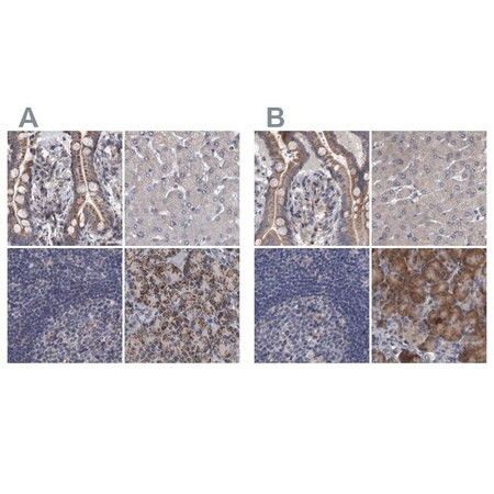 anti-dbt antibody produced in rabbit (c15-1451-074)