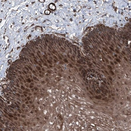 anti-coa7 antibody produced in rabbit (c15-1451-727)