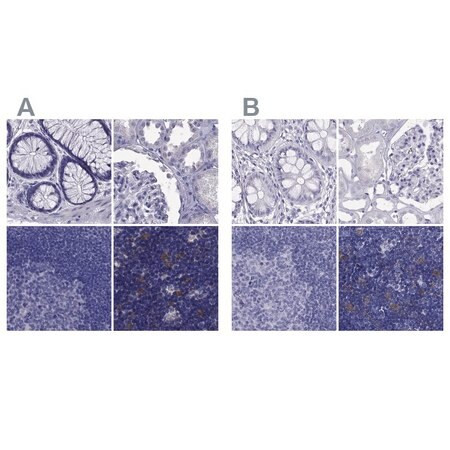 anti-psmb11 antibody produced in rabbit (c15-1452-072)