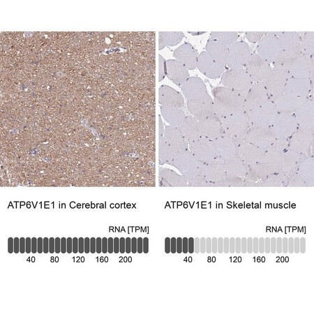 anti-atp6v1e1 antibody produced in rabbit