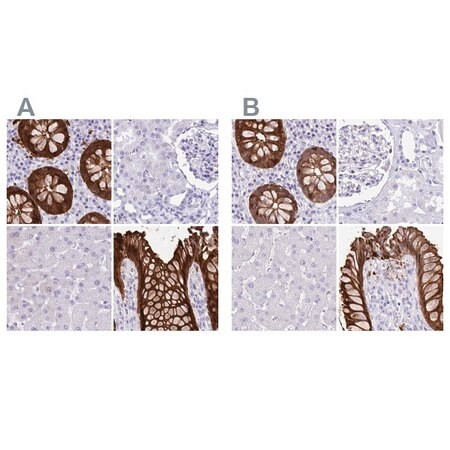 anti-lgals4 antibody produced in rabbit (c15-1453-015)