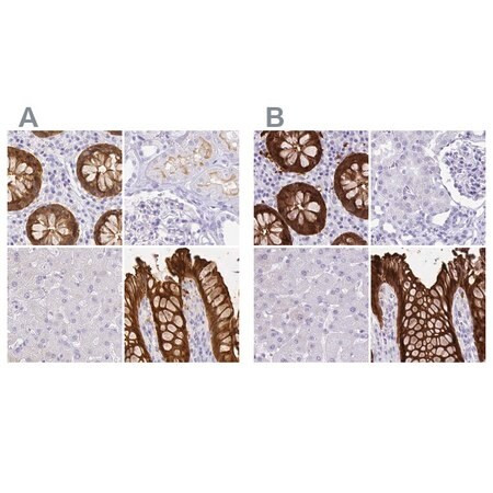anti-lgals4 antibody produced in rabbit (c15-1453-017)