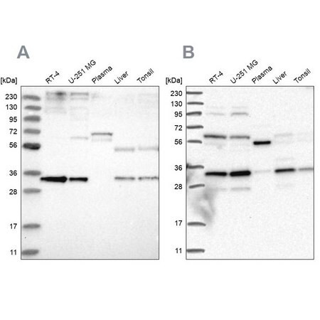 anti-ppcs antibody produced in rabbit (c15-1453-082)