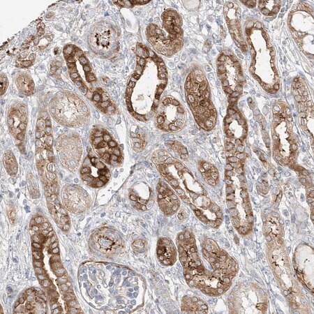 anti-dcdc2 antibody produced in rabbit (c15-1453-177)