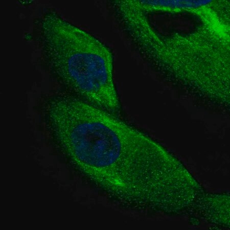 anti-dcdc2 antibody produced in rabbit (c15-1453-179)