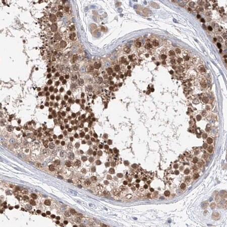 anti-rec8 antibody produced in rabbit (c15-1453-247)